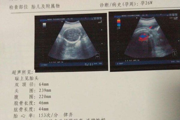 ���к��ӵ�֢״����Щ ������Բ�Ļ��Ǽ��