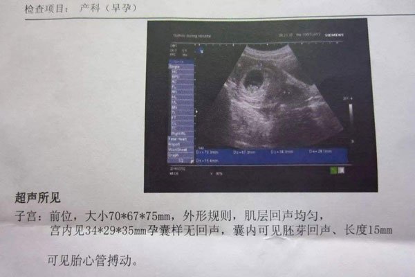 ���к��ӵ�֢״����Щ ������Բ�Ļ��Ǽ��