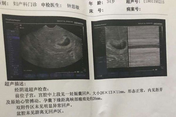 ���к��ӵ�֢״����Щ ������Բ�Ļ��Ǽ��