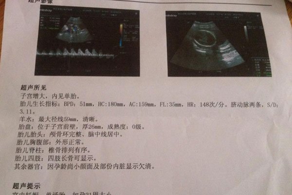 ҽ��˵���к����ص� ����������һ������������Ů