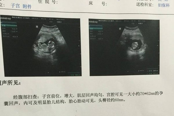 ҽ��˵���к����ص� ����������һ������������Ů