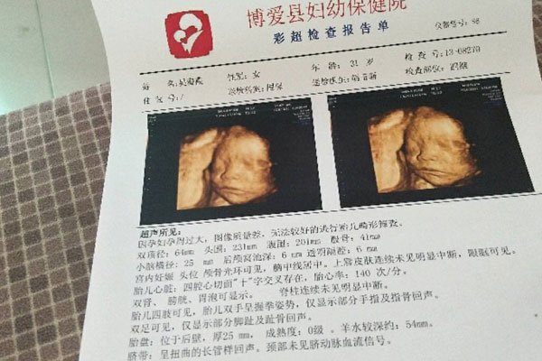 ҽ��˵���к����ص� ����������һ������������Ů