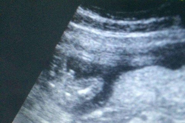 ҽ��˵���к����ص� ����������һ������������Ů