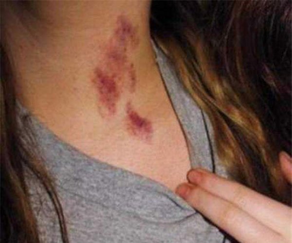 Ů�ĸ��е�����ݮ��ԭ�� �������ɵ�����ʡ��