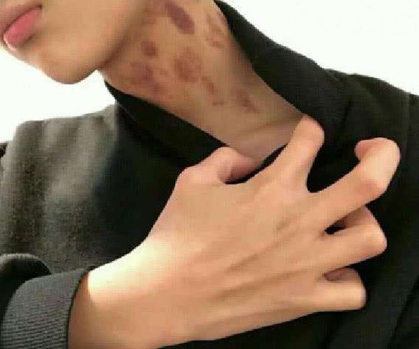 Ů�ĸ��е�����ݮ��ԭ�� �������ɵ�����ʡ��