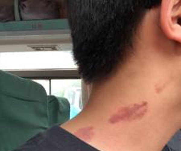 Ů�ĸ��е�����ݮ��ԭ�� �������ɵ�����ʡ��