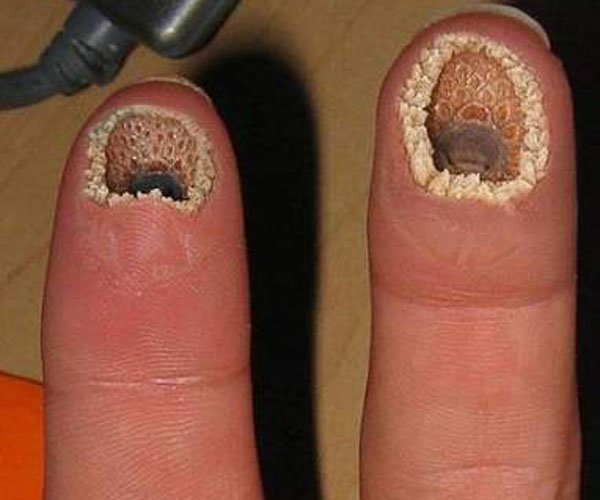 空手指恐(kǒng)怖图片 手指与八目鳗口部PS到一起