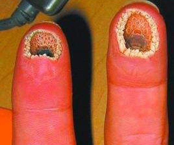 空手指恐怖图(tú)片 手指与八目鳗口部PS到一起