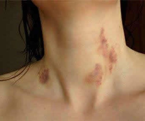 �ֲ�ݮ��ʲô��˼�� ���������Ǿ�һ���ᷢ����ϵ��