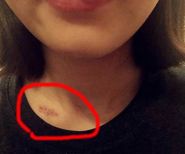 �ֲ�ݮ��ʲô��˼�� ���������Ǿ�һ���ᷢ����ϵ��