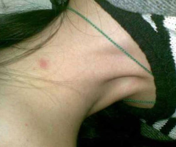 �ֲ�ݮ��ʲô��˼�� ���������Ǿ�һ���ᷢ����ϵ��