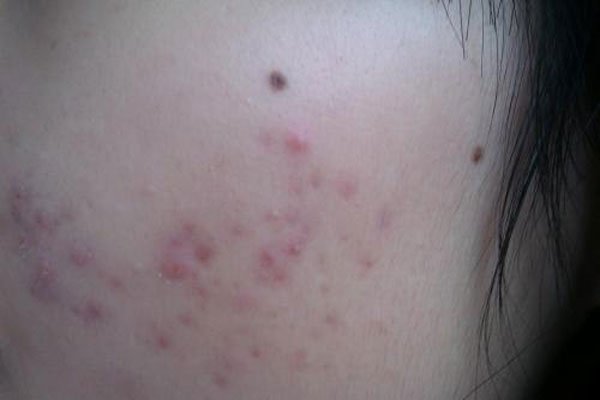 ��������Ƶ������� �����������ñ����