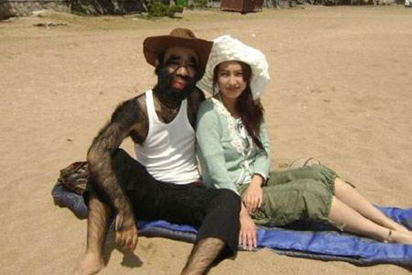 有"中国第一毛孩"之称的于震寰一出生便震惊世界,他出生在辽宁省岫岩