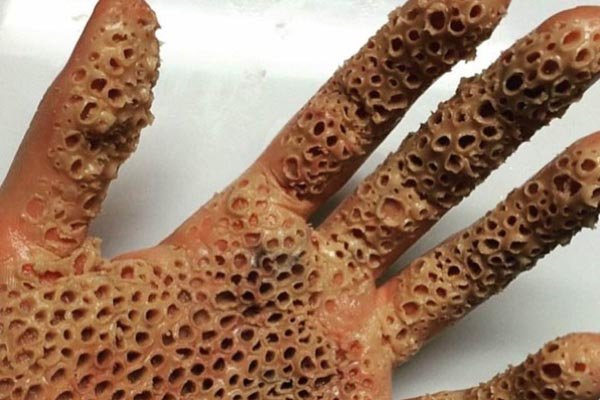 �����к�ʵ��ͼ �ܼ��־�֢����ǧ��Ҫ��