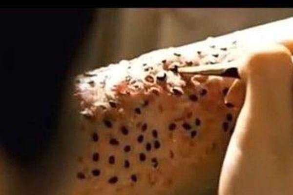 �����к�ʵ��ͼ �ܼ��־�֢����ǧ��Ҫ��