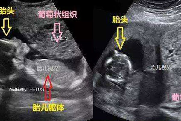 ����̥������ͼƬ ��һ�������п��ܷ����������