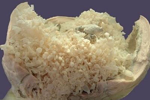 ����̥�ǰ�֢�� �������ֲ�����û�������Ŀ���