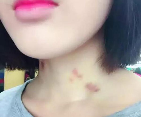 什么性格的男生会种草莓 太害羞了怎么出去见人