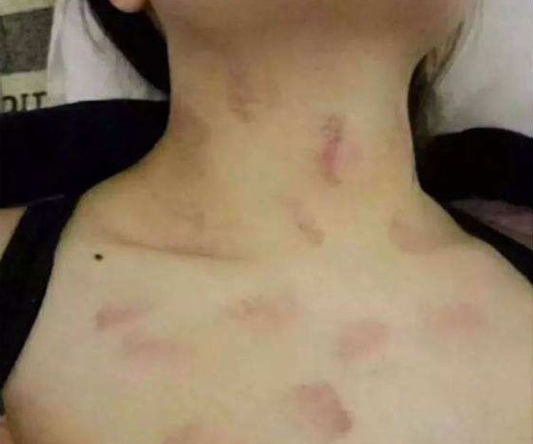 ʲô�Ը���������ֲ�ݮ ̫��������ô��ȥ����