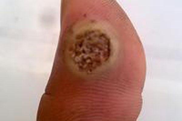 ����ָ�ֲ�ͼƬ ��ָ���Ŀ���ڲ�PS��һ��