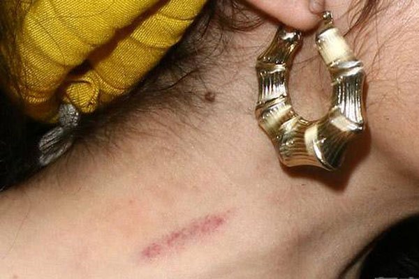 �������ֲ�ݮ�к��� �����е�����һ��Ҫע�⶯������