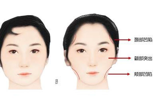 ��������ʲô�� �����׵�ʱ����Ҫ������ҽԺ