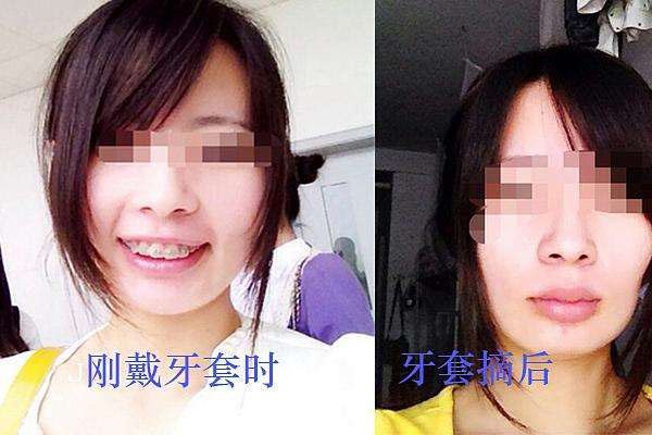 ��������ʲô�� �����׵�ʱ����Ҫ������ҽԺ