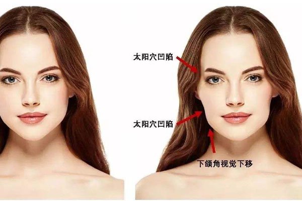 ��������ʲô�� �����׵�ʱ����Ҫ������ҽԺ