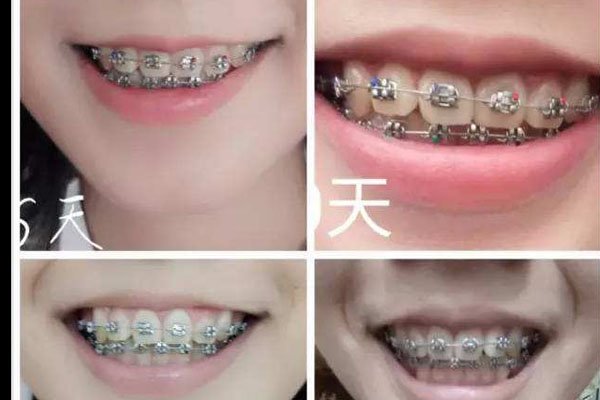 ��������ʲô�� �����׵�ʱ����Ҫ������ҽԺ