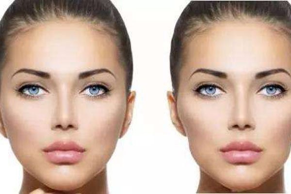 ��������ʲô�� �����׵�ʱ����Ҫ������ҽԺ