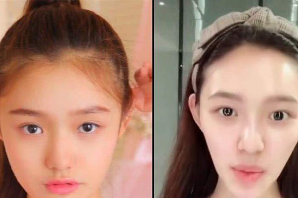 ��������ʲô�� �����׵�ʱ����Ҫ������ҽԺ