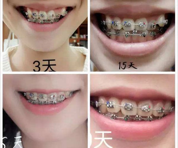 ��������ָ��� Ϊ���������Ĵ���