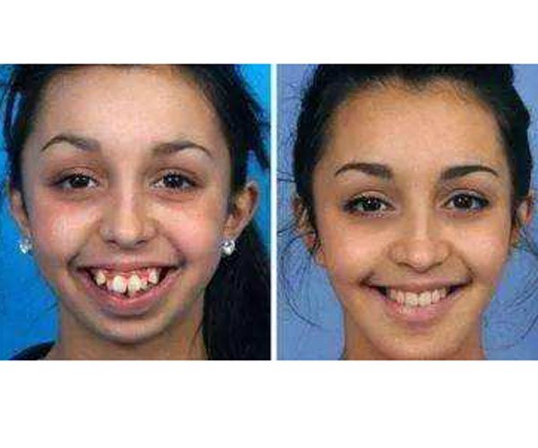 ��������ָ��� Ϊ���������Ĵ���