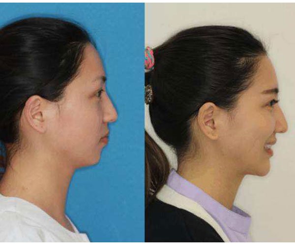 ��������ָ��� Ϊ���������Ĵ���