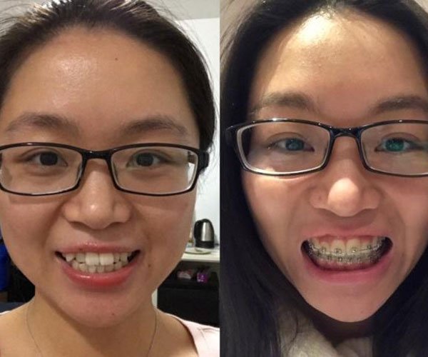 ��������ָ��� Ϊ���������Ĵ���