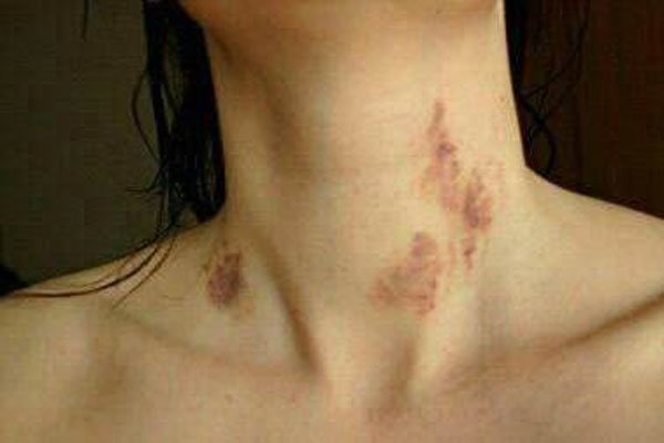 ������ݮ��ʲô���� ���˱�����ݮ�������ô����