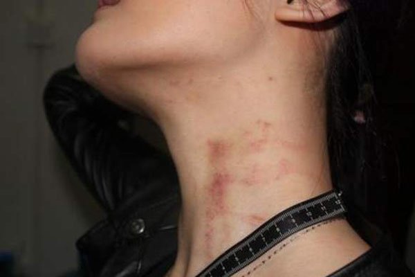 ������ݮ��ʲô���� ���˱�����ݮ�������ô����