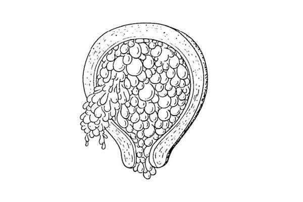 ����̥��ʲô ��ɱ��̥����ô��ô����