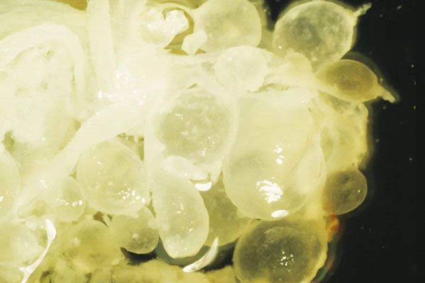 ����̥��ʲô ��ɱ��̥����ô��ô����