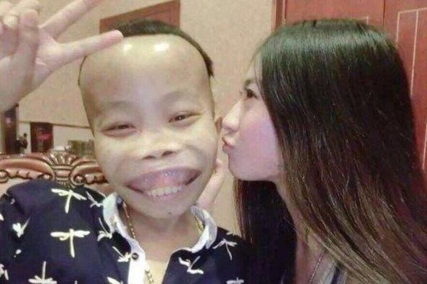 ��ɽ����ʵ���� ����ɱ�Ŀ��ֺ�������ȥ������