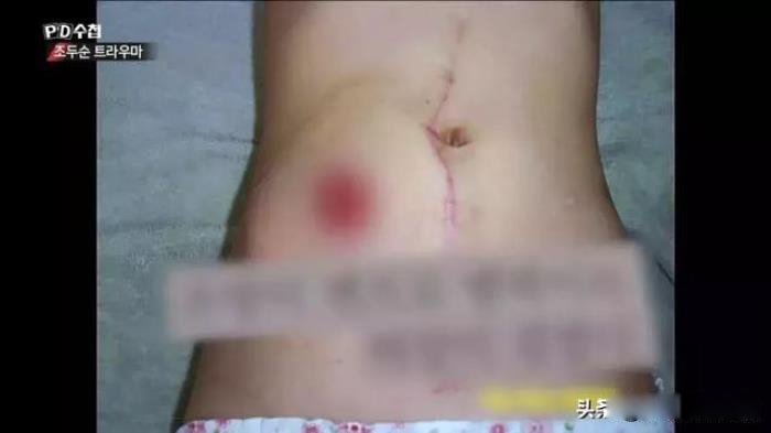 素媛案件真实故事过程 原型真实女孩怎么样了