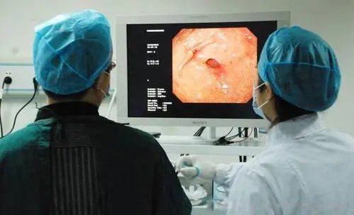 肠镜为什么尽量不要做年轻人最好不要做肠镜的原因