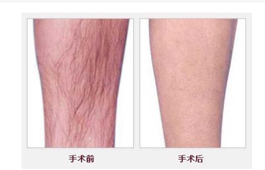 �����˼�����ë����� ����ܳ���������ë��