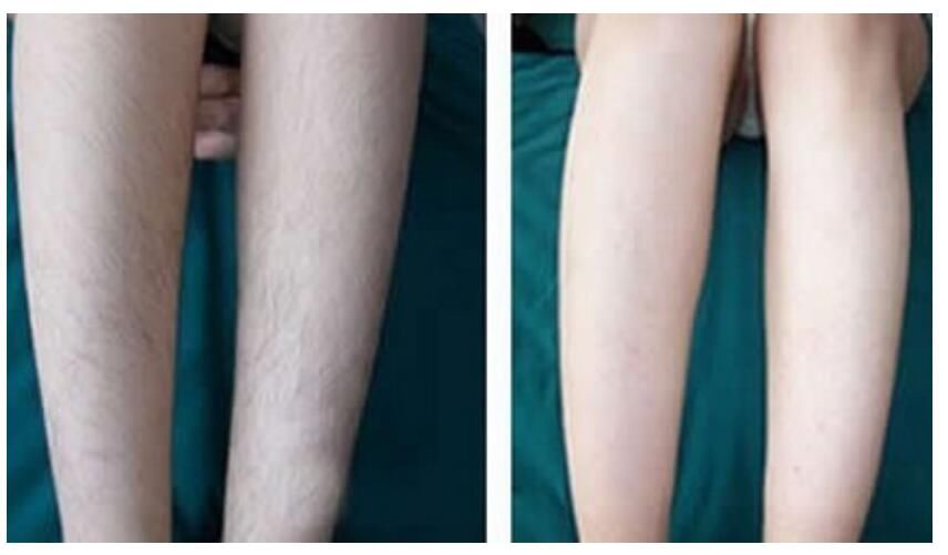 �����˼�����ë����� ����ܳ���������ë��