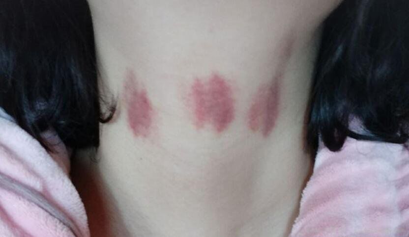 草莓印照片胸前图片