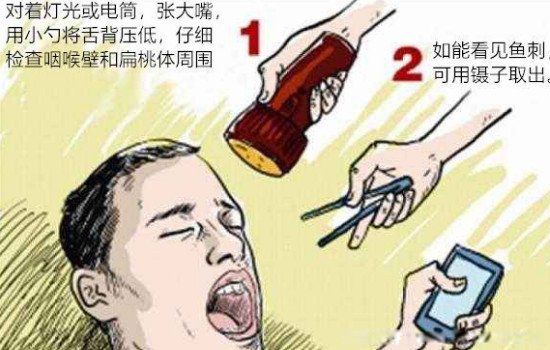鱼刺卡在喉咙里怎么办 五种最快的消除方法
