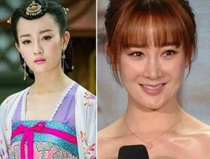 张檬为什么要整容呀 整容记图片判若两人坦言很后悔