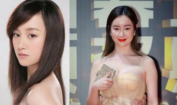 张檬为什么要整容呀 整容记图片判若两人坦言很后悔