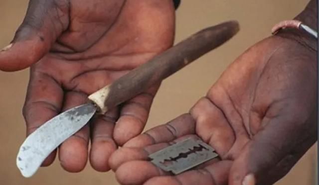 非洲割礼是什么意思 是怎么样的到底是割哪