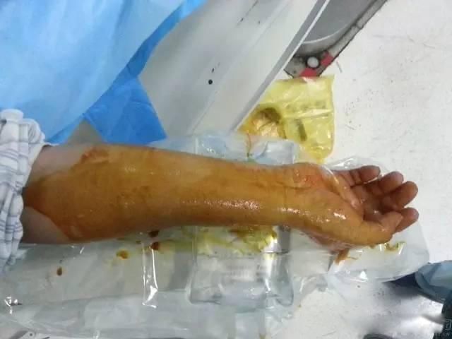 dsaҽѧ����ʲô��˼ ����dsa��Ӱ��ʲô���